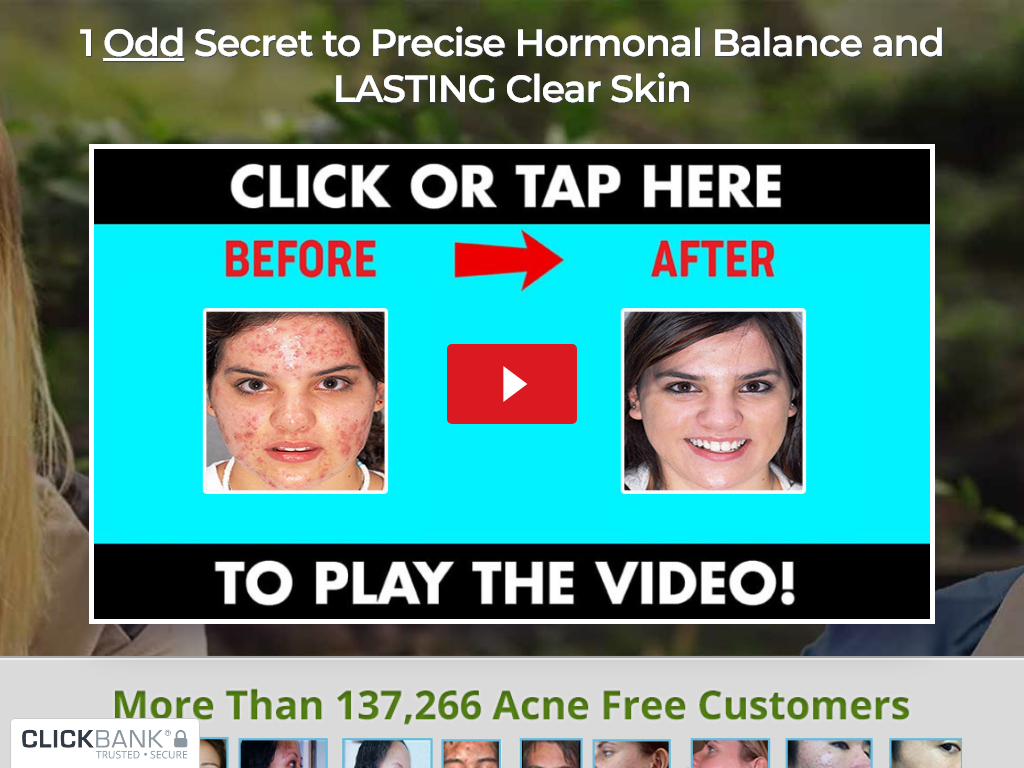 ACNE NO MORE REVIEW : THE CHANGE AFTER 1 MONTH