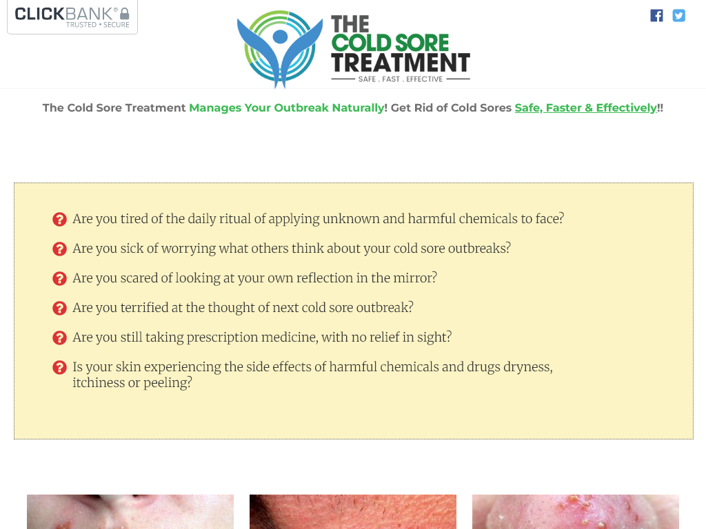 COLD SORE TREATMENT REVIEW | I FOUND THE ANSWER IN 5 SECONDS