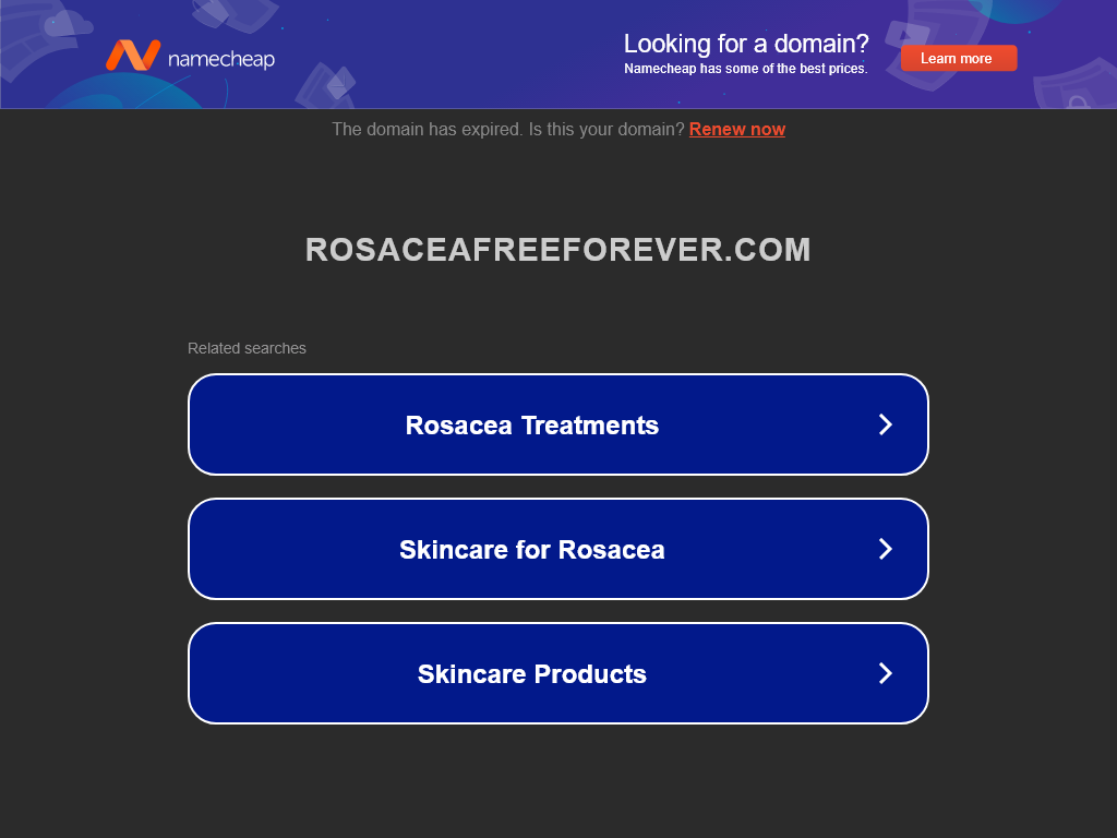 ROSACEA FREE FOREVER REVIEW – I REGRET NOT STARTING 1 MONTH AGO