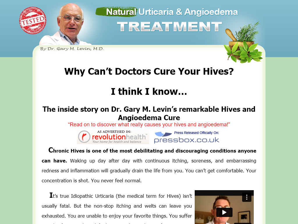 URTICARIA & ANGIOEDEMA NATURAL TREATMENT SYTEM REVIEW : DO NOT IGNORE THIS WARNING!